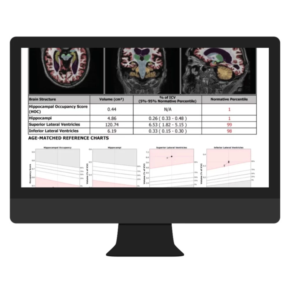 Cortechs-ai NeuroQuant & LesionQuant2.jpg