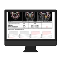 Cortechs-ai NeuroQuant & LesionQuant2.jpg