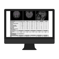 Cortechs-ai NeuroQuant & LesionQuant3.jpg
